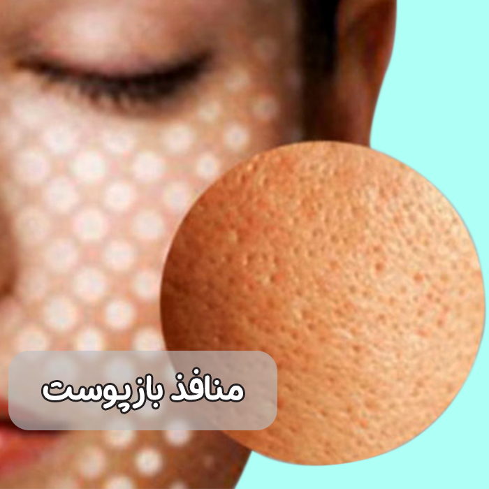 منافذ باز پوست